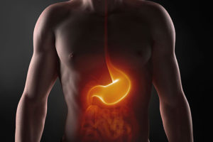 Síntomas de la acidez estomacal o ardor de estómago